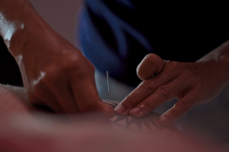 Susy Qi Acupuncture photo 3