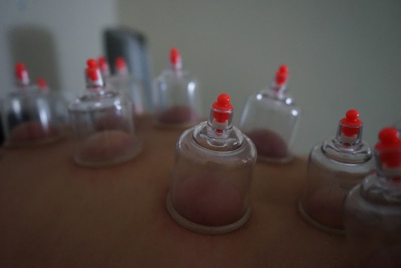 Susy Qi Acupuncture photo 4