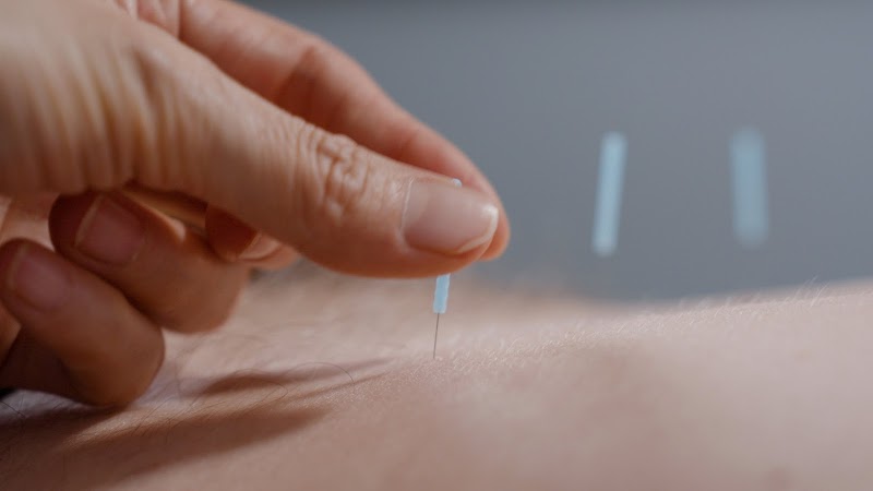 Kelly 121 Acupuncture