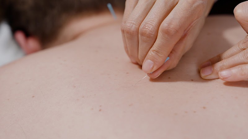 Kelly 121 Acupuncture photo 2