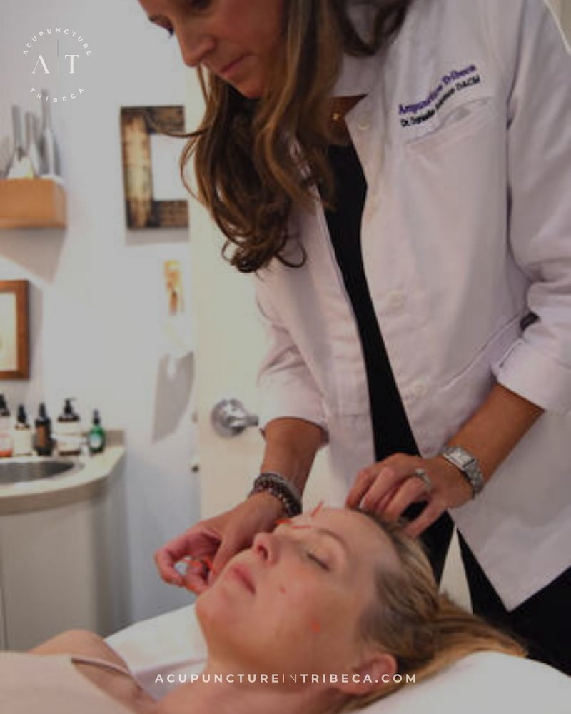 Acupuncture Tribeca
