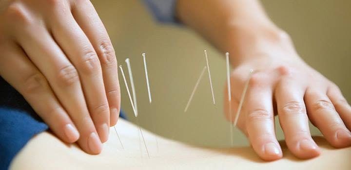 H & Z Acupuncture | Advanced Acupuncture Clinic