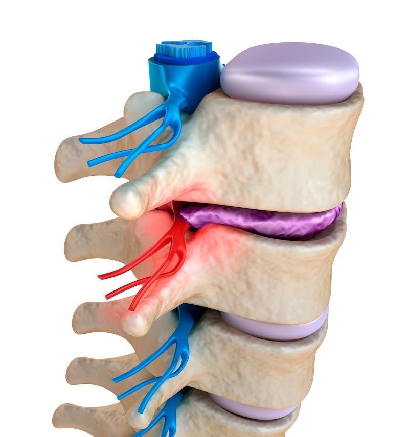 NJ Nerve Chiropractic & Laser