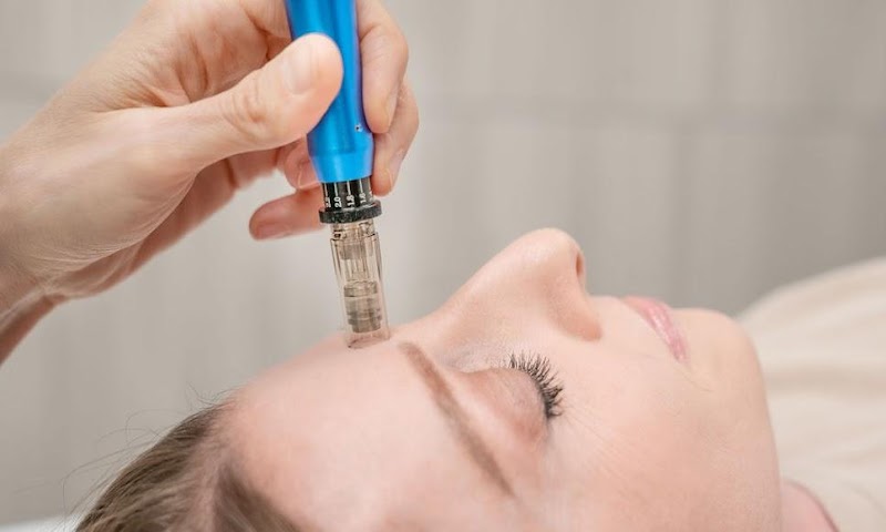 Needle & Glow - Acupuncture & Women's Health photo 3