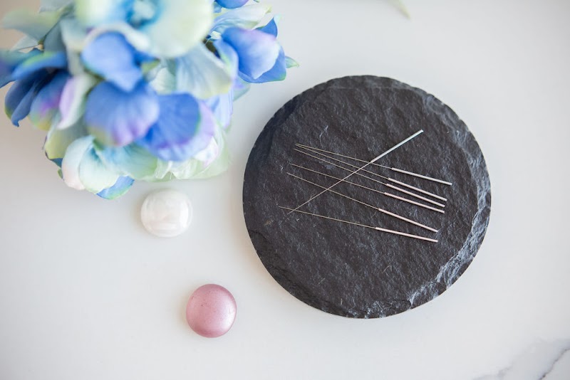 Needle & Glow - Acupuncture & Women's Health photo 5
