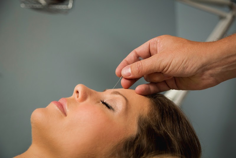 Uptown Acupuncture photo 5