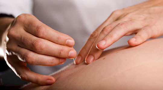 Mother Nature's Acupuncture & Chinese Herbs photo 2