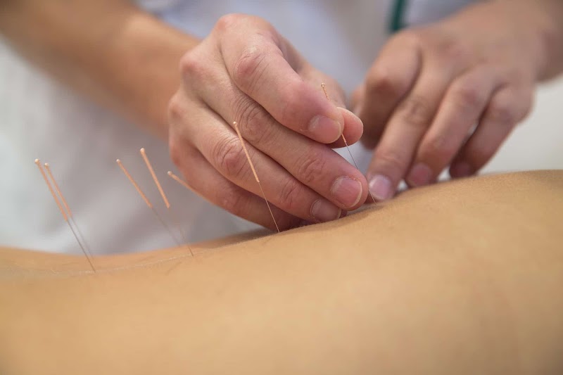 Madison Acupuncture