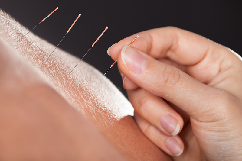 Li Wellness Acupuncture
