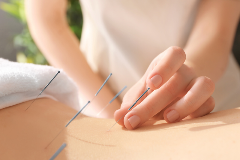 Li Wellness Acupuncture photo 2