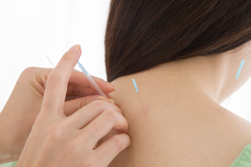 Li Wellness Acupuncture photo 3