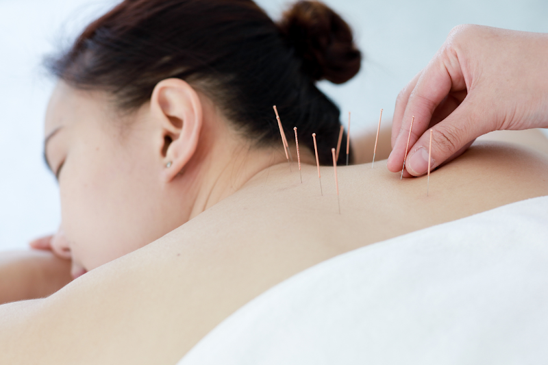 Li Wellness Acupuncture photo 4