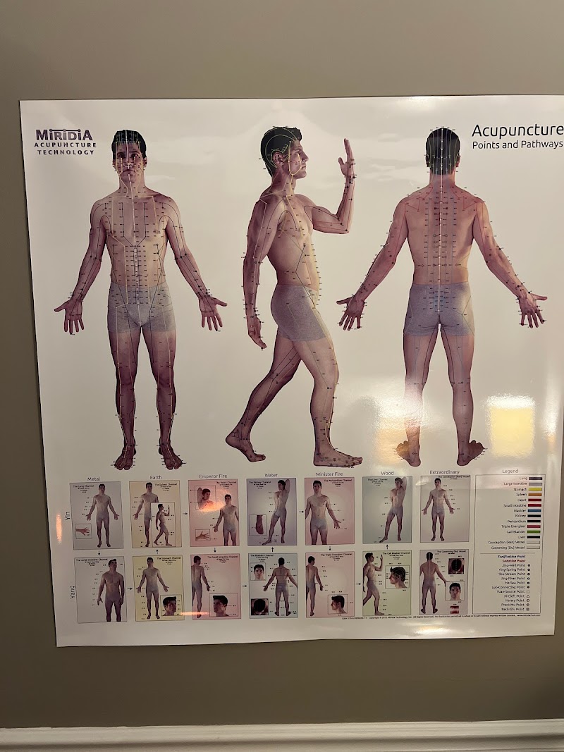 The Point: The Place for Acupuncture photo 4