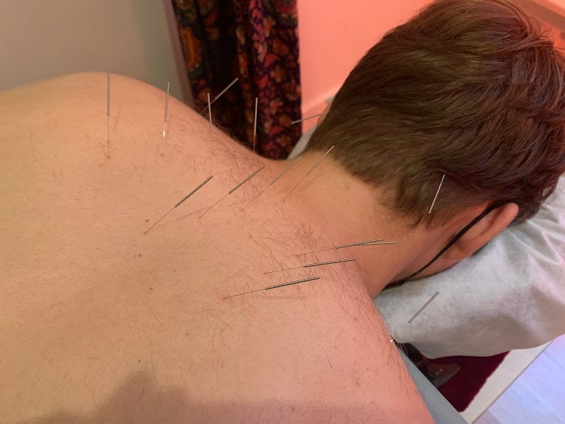 Lifestyle Acupuncture photo 4
