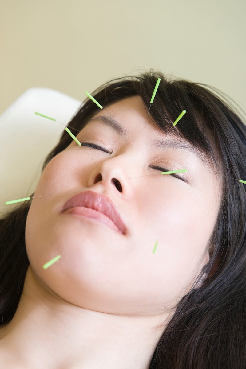 Lifestyle Acupuncture photo 5