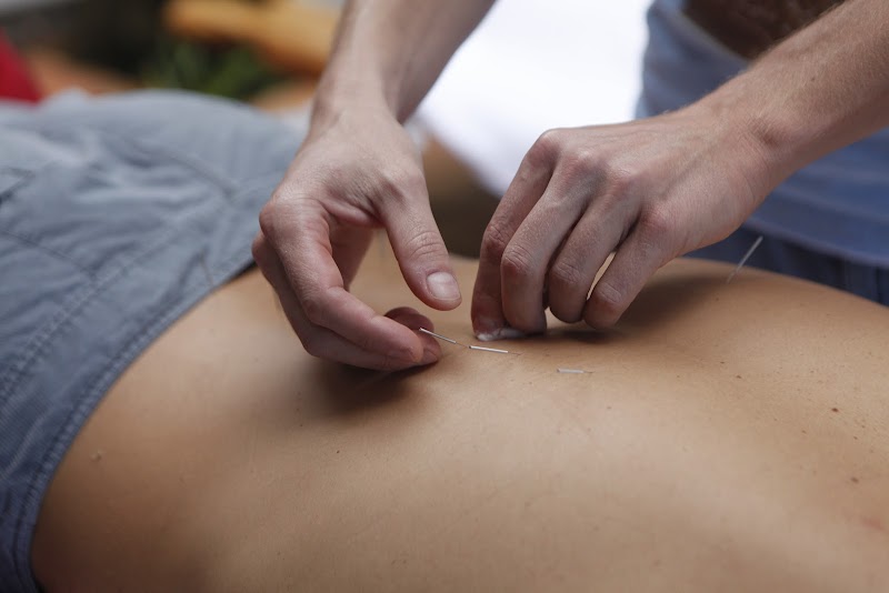BF Acupuncture