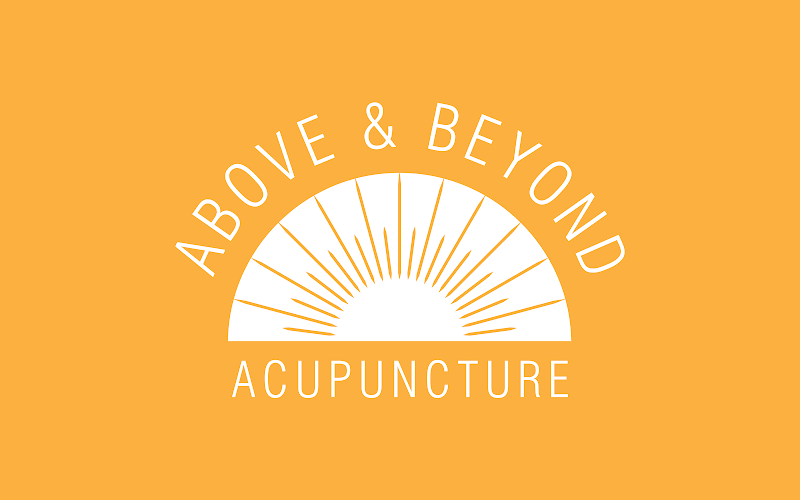 Above & Beyond Acupuncture Scottsdale photo 3
