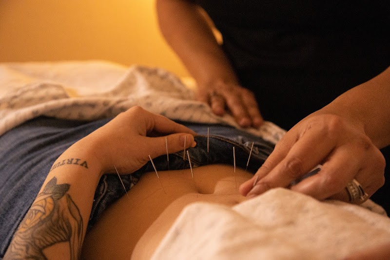 The Point Acupuncture And Dry Needling Clinic photo 5