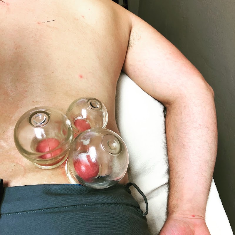 JASA Clinic-Acupuncture photo 4