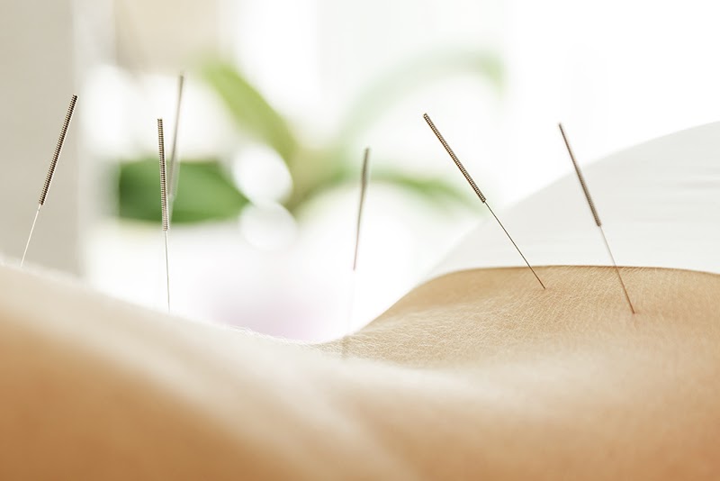 heidrunjacobi acupuncture