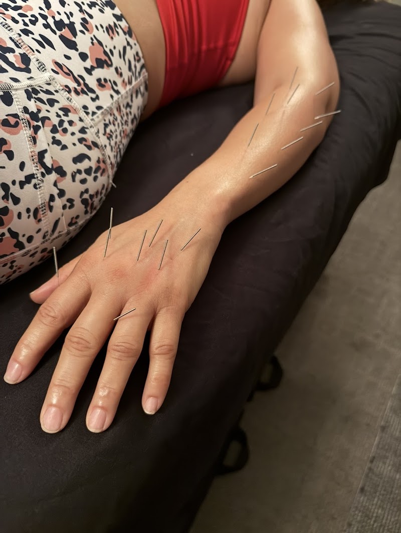 Anna Hajosi Acupuncture & Pilates photo 2