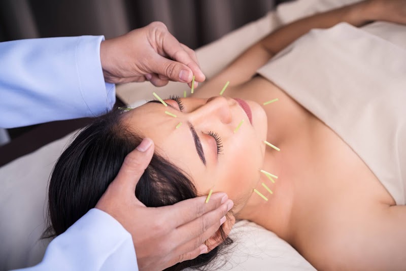 Acupuncture Midtown NYC photo 5