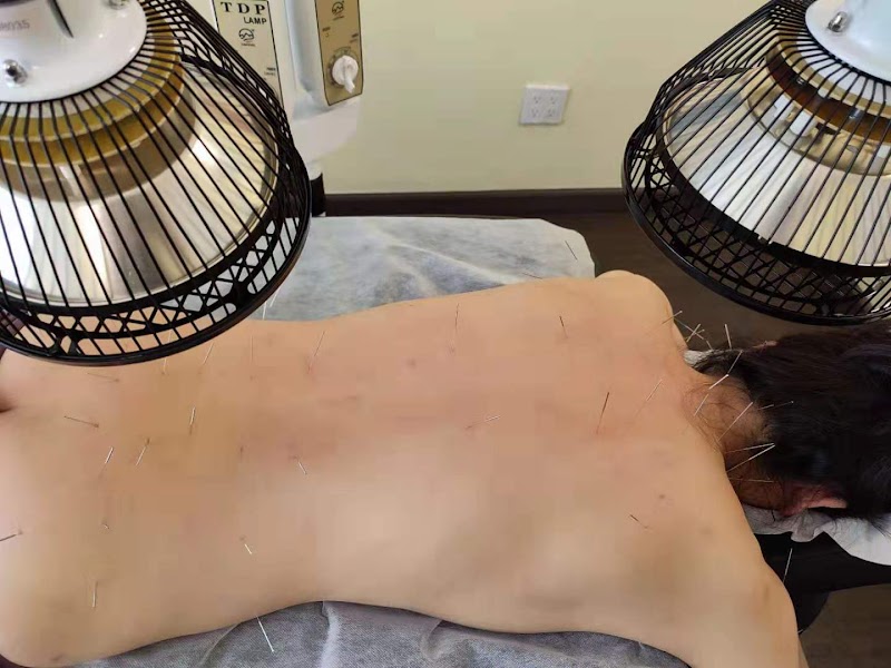 Li Qian Acupuncture photo 2