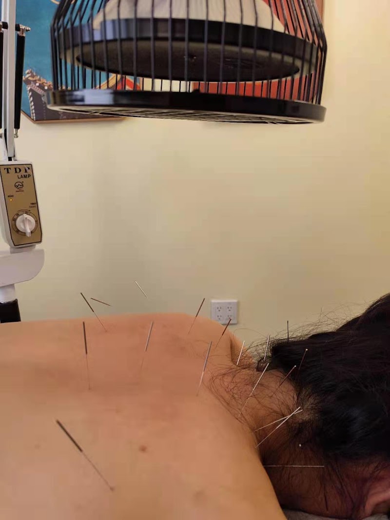 Li Qian Acupuncture photo 3