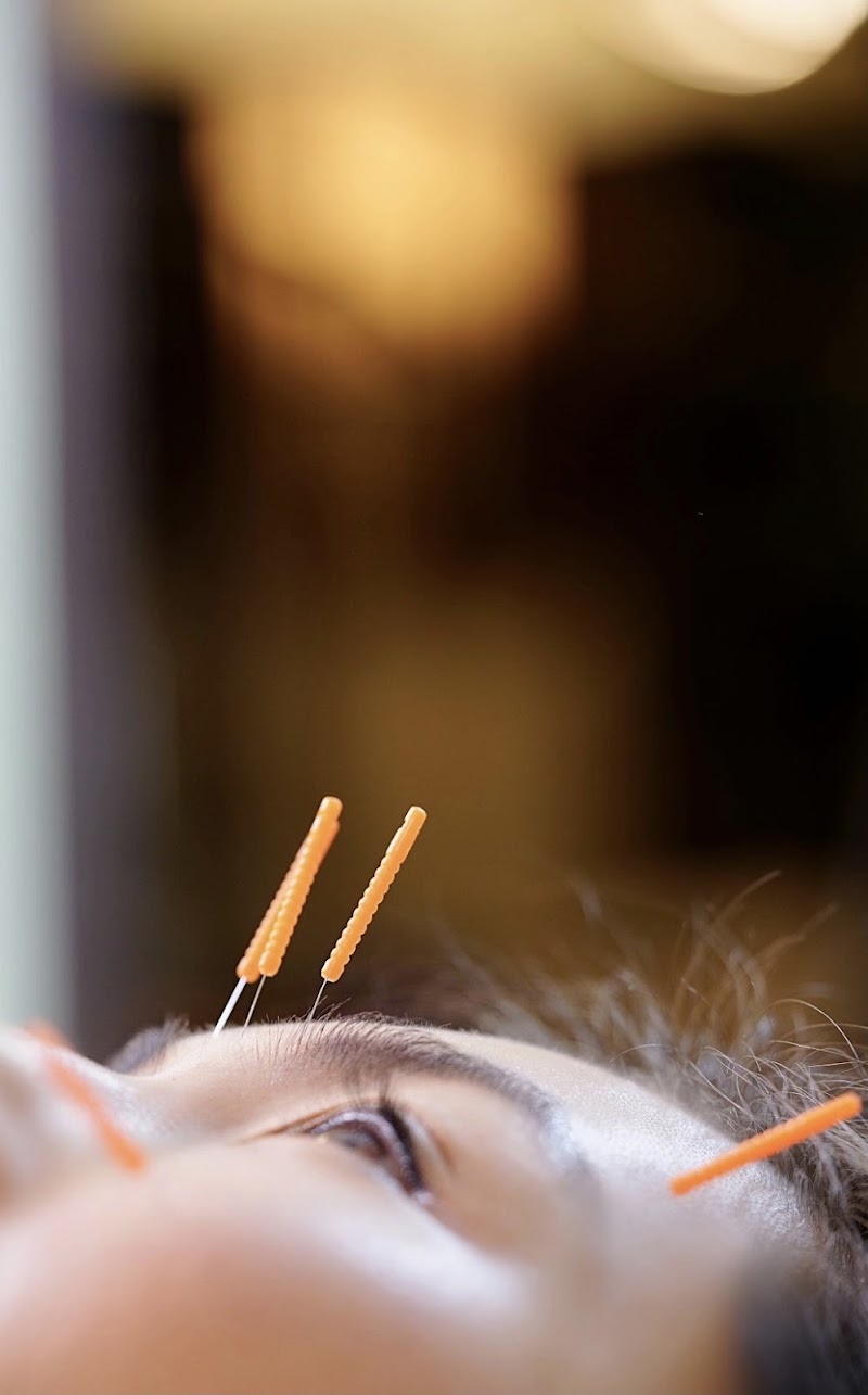 Li Qian Acupuncture photo 5