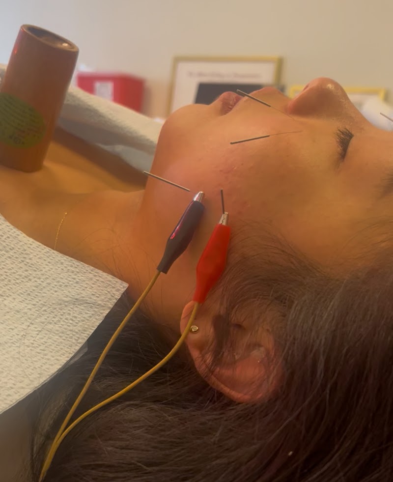Qi Lu Acupuncture photo 3