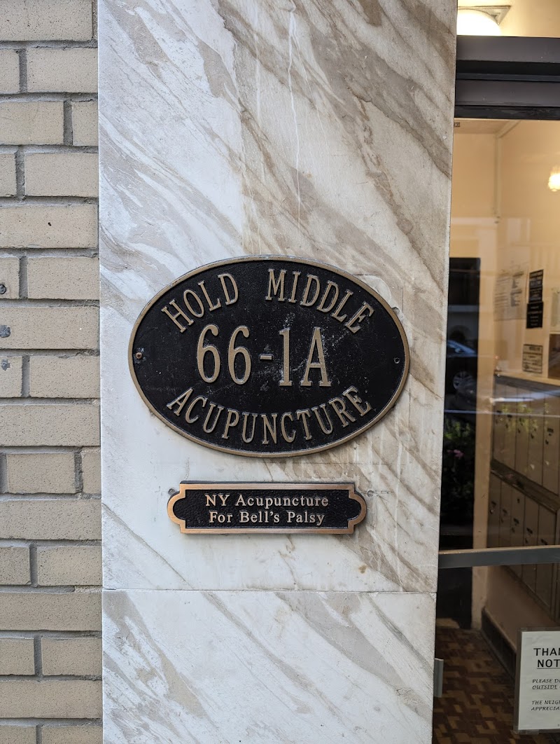 Hold Middle Acupuncture photo 4