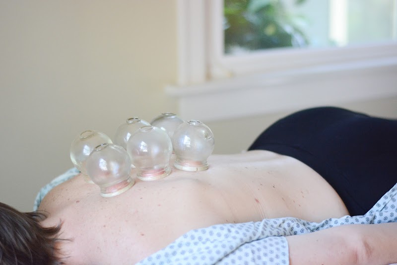 Green Lotus Acupuncture, LLC photo 5