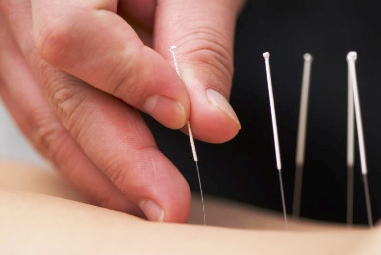 Chinatown Acupuncture Clinic-Jeffrey Chan Acupuncture And Herbal Medicine center photo 2