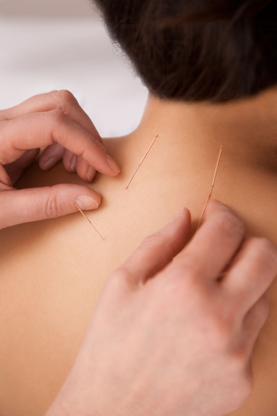 Chinatown Acupuncture Clinic-Jeffrey Chan Acupuncture And Herbal Medicine center photo 4