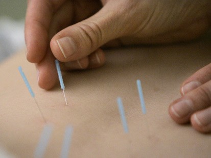 Chinatown Acupuncture Clinic-Jeffrey Chan Acupuncture And Herbal Medicine center photo 5