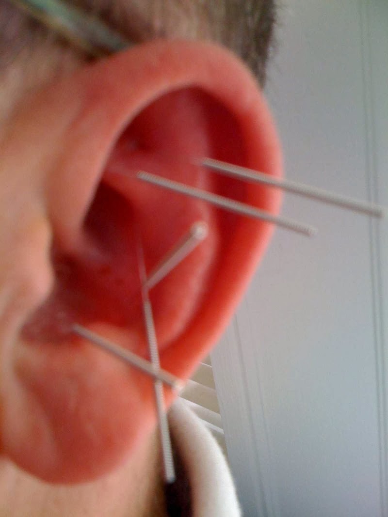 Center & Spring Acupuncture photo 4