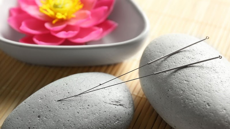 DH Acupuncture photo 3