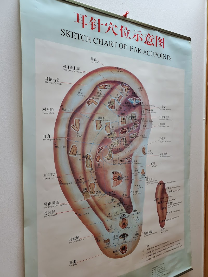 Traditional Chinese Medicine and Accupuncture Services, Dr. Wu, Yi Qiao