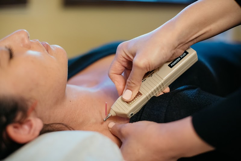 SF Holistic Medicine Acupuncture, Dry Needling, Cosmetic Acupuncture + Microneedling & Functional Medicine