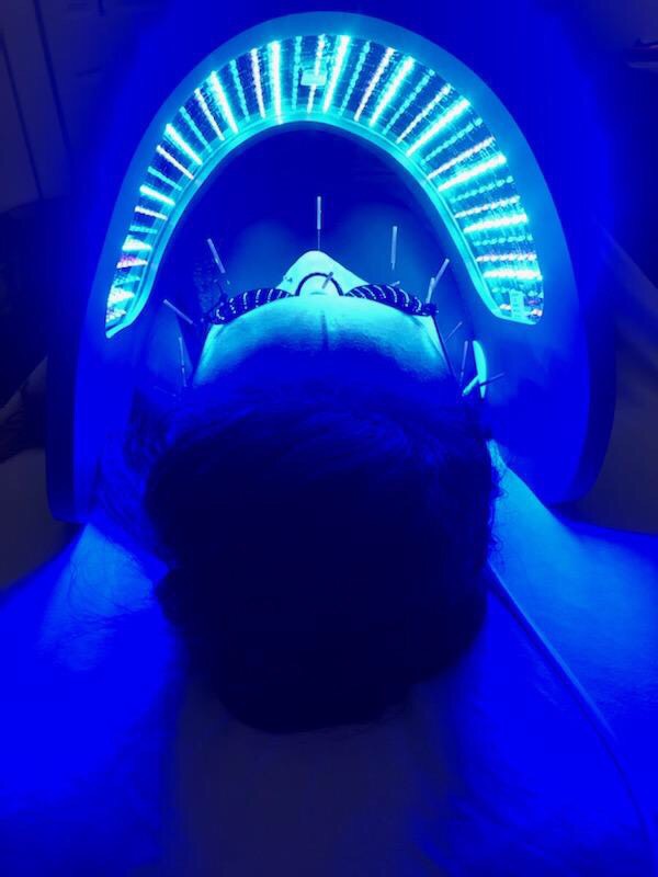 SF Holistic Medicine Acupuncture, Dry Needling, Cosmetic Acupuncture + Microneedling & Functional Medicine photo 4