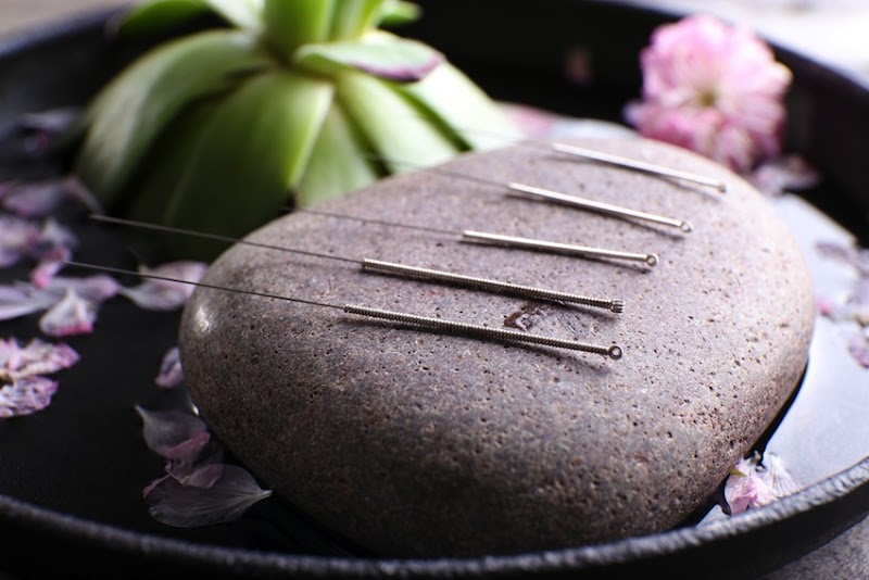 True Path Acupuncture & Wellness photo 2