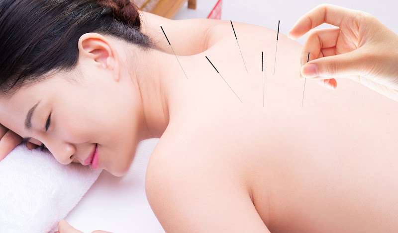 Z&li wellness acupuncture PLLC