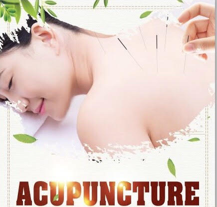 Z&li wellness acupuncture PLLC photo 3