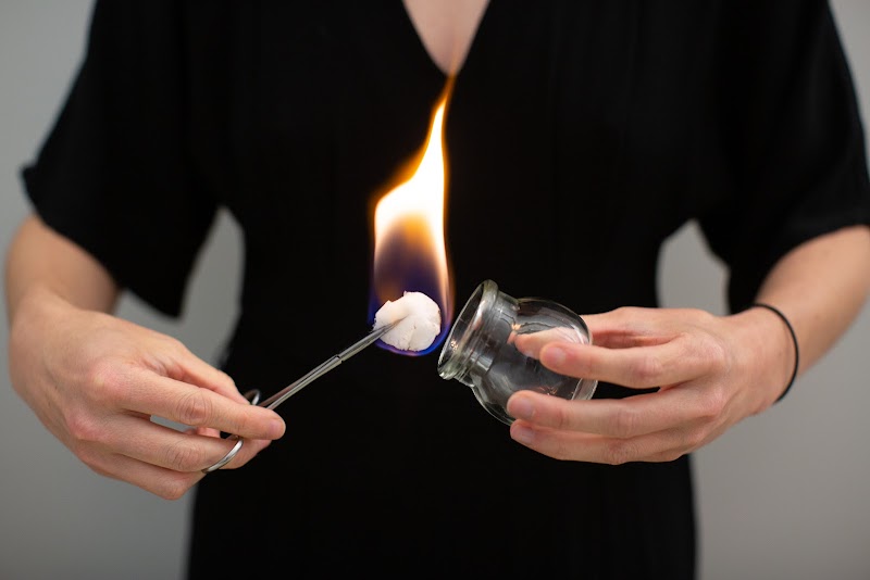San Francisco Integrative Medicine and Dry Needling