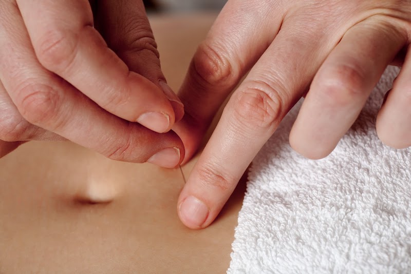 ACA Acupuncture & Wellness - Washington Heights photo 3