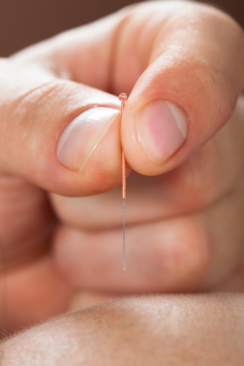 ACA Acupuncture & Wellness - Washington Heights photo 5