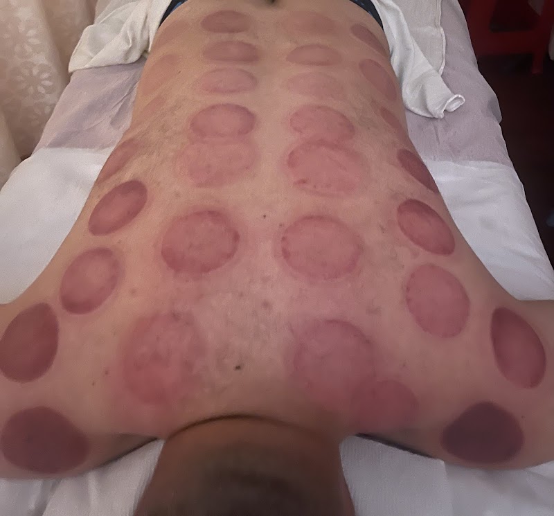 Xinhe Natural Acupuncture PC photo 4