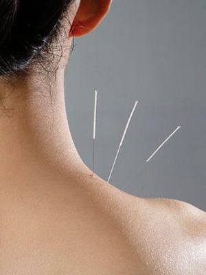Nashville Acupuncture Clinic