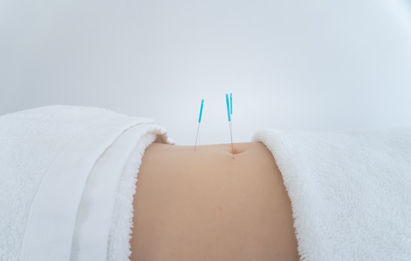 Ease and Balance Acupuncture photo 2