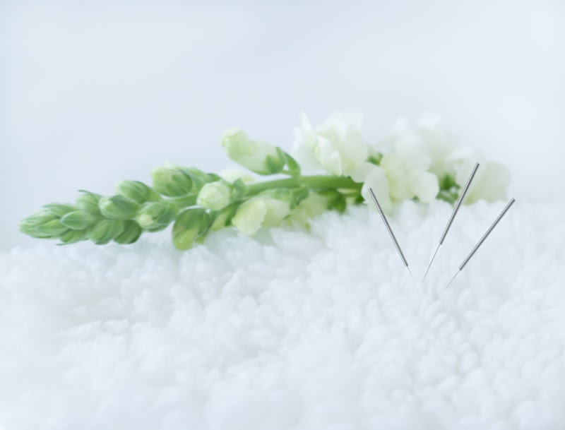 Ease and Balance Acupuncture photo 5